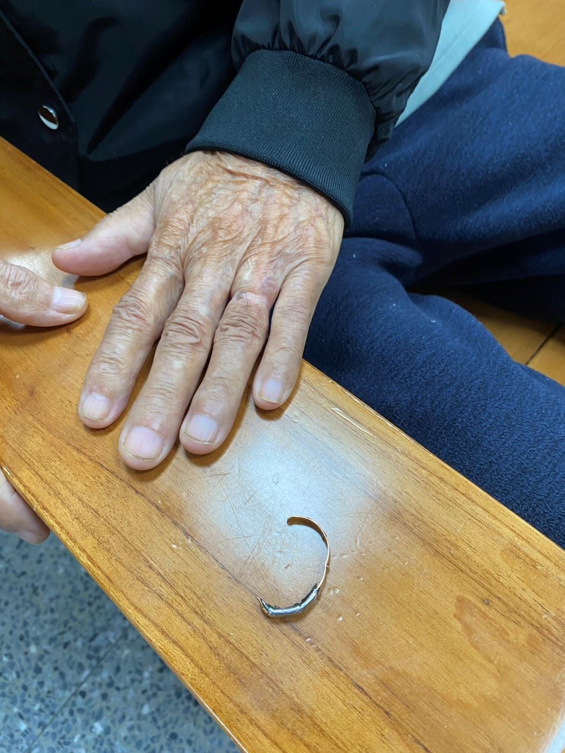 民眾卡戒指求助消防隊